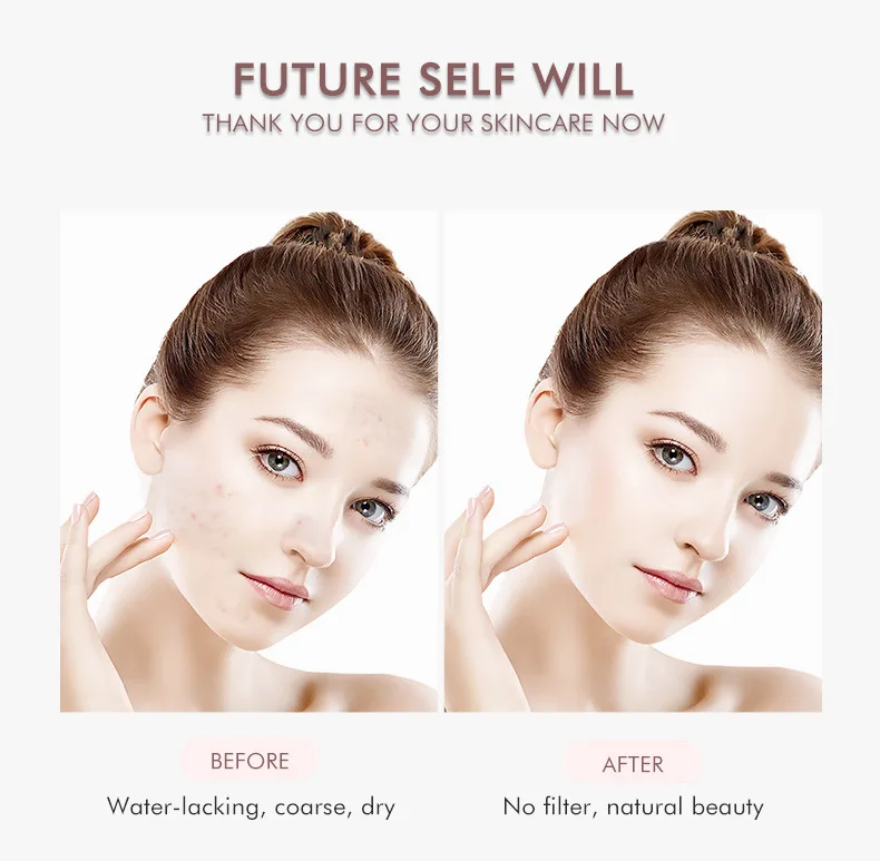 kf-Sbd3bfa0e31094002819e44a86105fdf0I